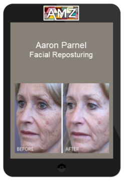 Aaron Parnel – Facial Reposturing