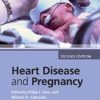 Heart Disease and Pregnancy 2nd Edition