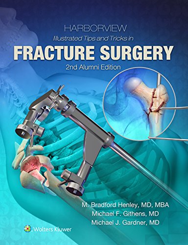 Harborview Illustrated Tips and Tricks in Fracture Surgery 2nd Edition