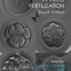 Handbook of In Vitro Fertilization 4th Edition